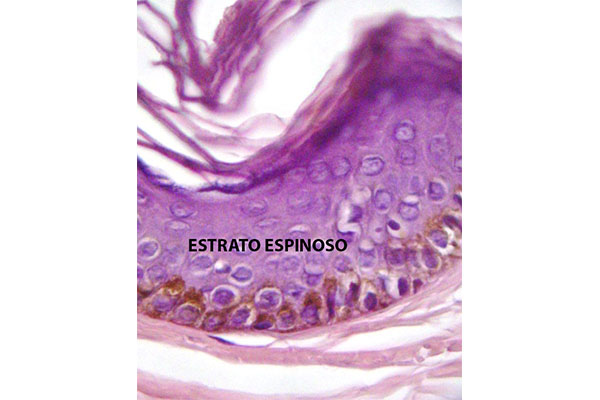 En este momento estás viendo Estrato espinoso