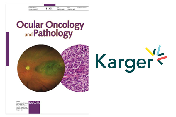 HER2 Overexpression in Retinoblastoma: A Potential Therapeutic Target?