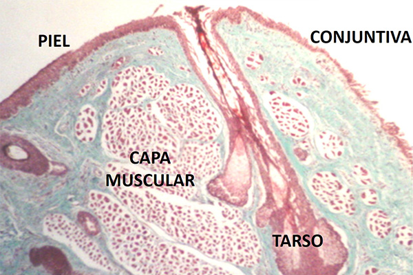 En este momento estás viendo Dibujo esquemático y corte histológico del borde libre del párpado