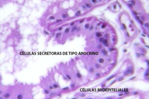 Lee más sobre el artículo Glándula de Moll