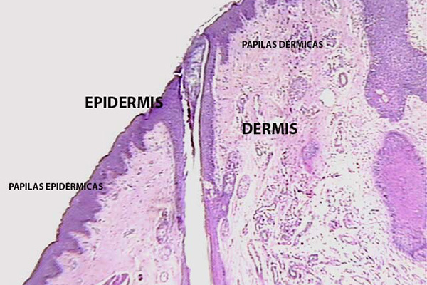 En este momento estás viendo Piel (epidermis y dermis)