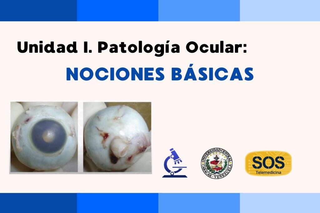 Unidad I. Patología Ocular: Nociones básicas