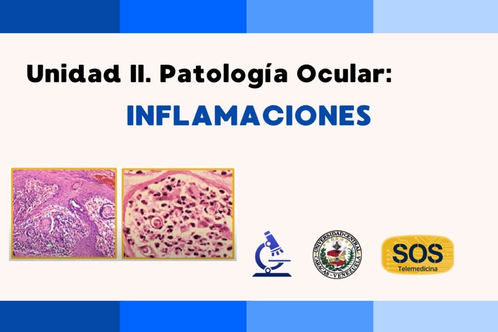 Unidad II. Patología Ocular: Inflamaciones