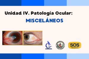 Lee más sobre el artículo Unidad IV. Patología Ocular: Misceláneos
