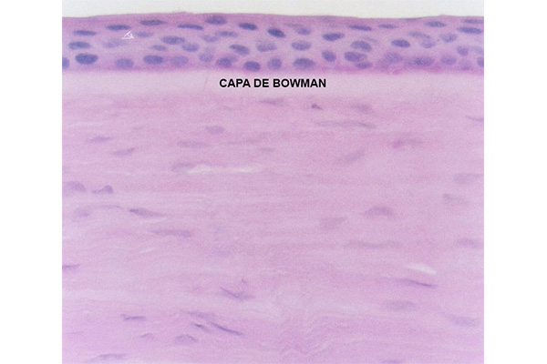 En este momento estás viendo Capa de Bowman