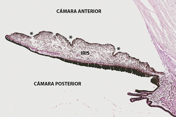 En este momento estás viendo Criptas de Fuchs