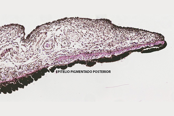 En este momento estás viendo Epitelio pigmentado posterior