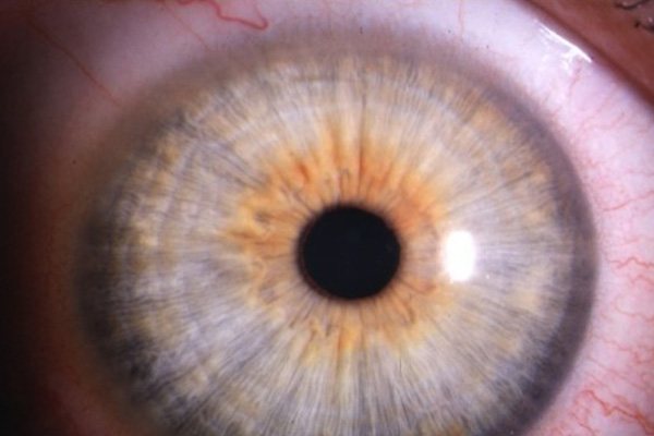 En este momento estás viendo Iris claro