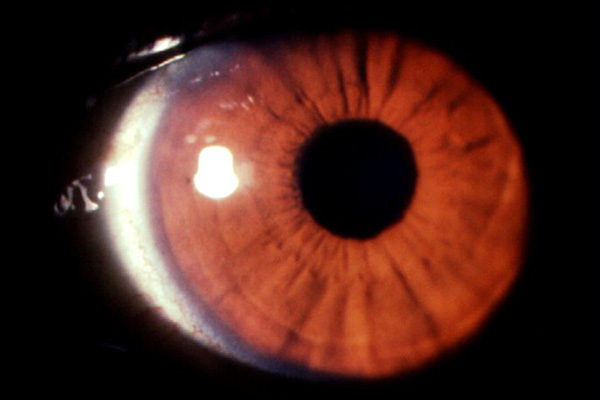 En este momento estás viendo Iris oscuro