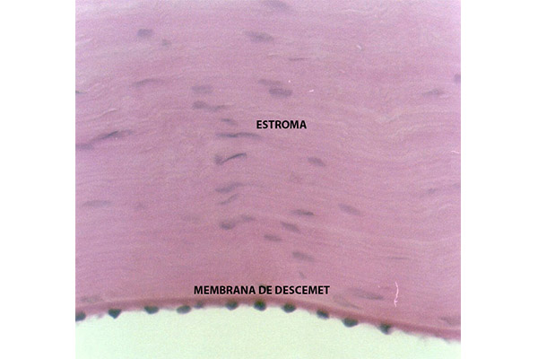 En este momento estás viendo Membrana de Descemet (H/E y PAS)