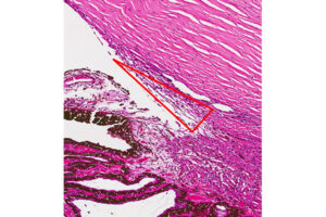 Lee más sobre el artículo Red trabecular