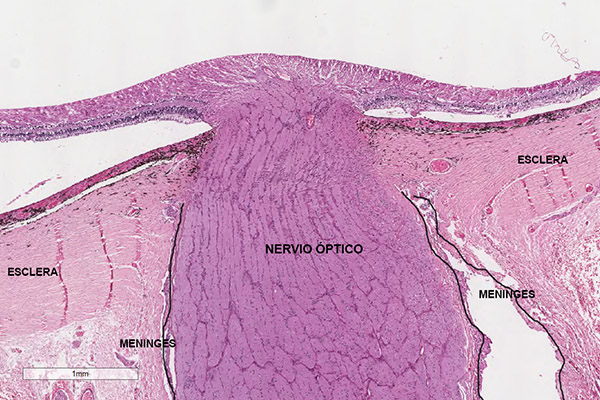 En este momento estás viendo Células meningoteliales