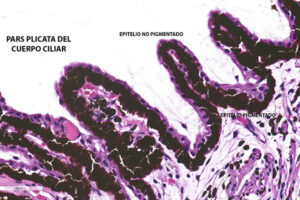 Lee más sobre el artículo Epitelio de los procesos ciliares (con y sin pigmento)