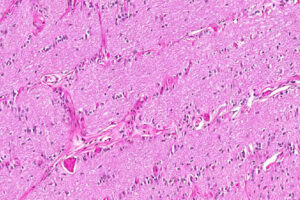 Lee más sobre el artículo Glía del nervio óptico