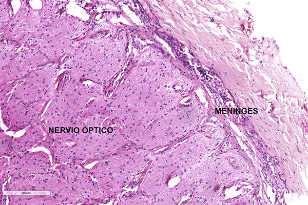 En este momento estás viendo Histología del nervio óptico