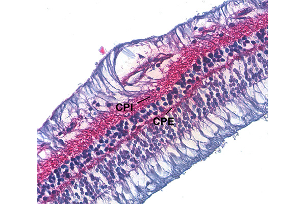 En este momento estás viendo Inmunohistoquímica de la capa plexiforme interna