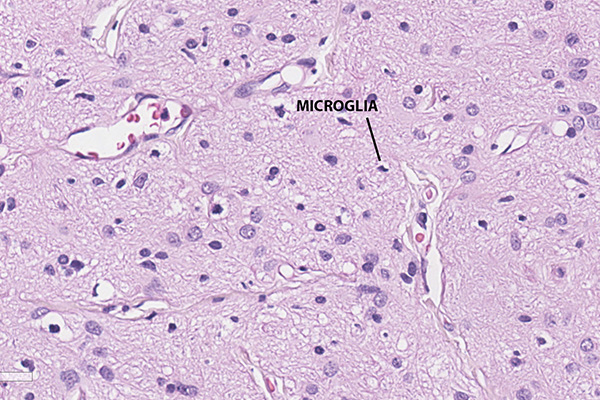 En este momento estás viendo Microglia