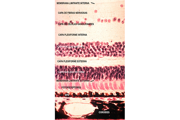 En este momento estás viendo Retina